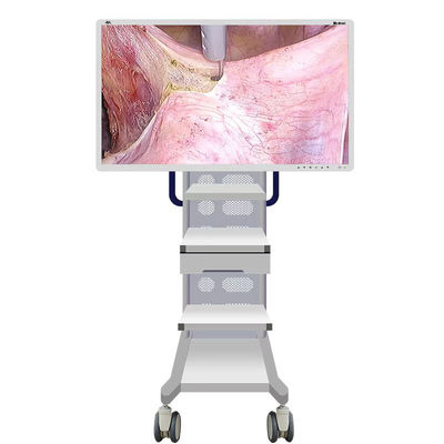 Kamera Monitor Endoskopi Medis Dengan Layar 55 inci