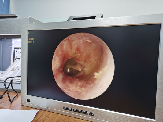 Monitor 22 Inci Terintegrasi THT Full HD Endoscope Camera System Set Portable