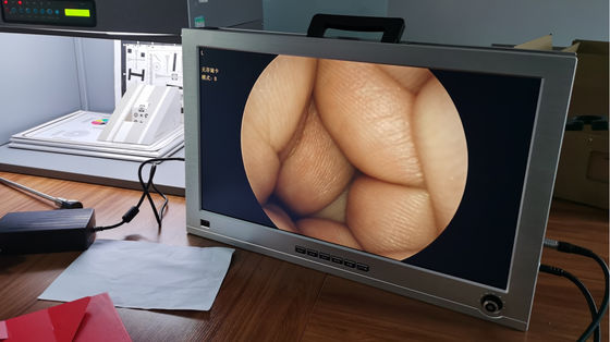 Monitor 22 Inci Terintegrasi THT Full HD Endoscope Camera System Set Portable