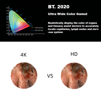 DEC 3840A Sistem Kamera Endoskopi Medis 4K Ultra HD Baru Untuk Laparoskopi